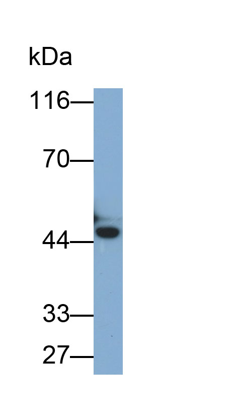 Monoclonal Antibody to Cytokeratin Fragment Antigen 21-1 (CYFRA21-1)
