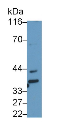 Monoclonal Antibody to Beta-1,3-Glucuronyltransferase 1 (b3GAT1)