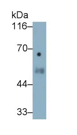 Monoclonal Antibody to Elastin (ELN)