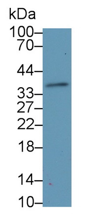 Monoclonal Antibody to Cluster Of Differentiation 147 (CD147)
