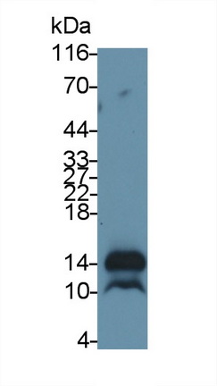 Monoclonal Antibody to Trefoil Factor 3 (TFF3)