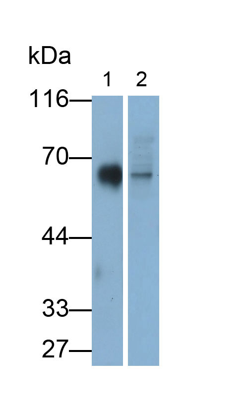 Monoclonal Antibody to Cluster Of Differentiation 226 (C<b>D226</b>)