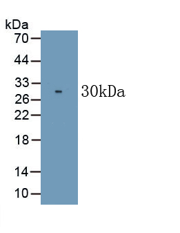 Monoclonal Antibody to Cluster Of Differentiation 226 (C<b>D226</b>)