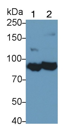Monoclonal Antibody to Complement Component 1, S Subcomponent (C1s)