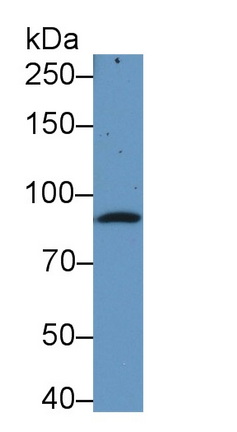 Monoclonal Antibody to Complement Component 1, S Subcomponent (C1s)