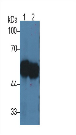 Monoclonal Antibody to Cytokeratin 17 (CK17)