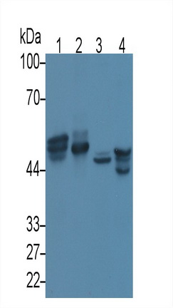 Monoclonal Antibody to Cytokeratin 17 (CK17)
