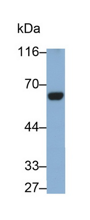 Monoclonal Antibody to Coagulation Factor XI (F11)