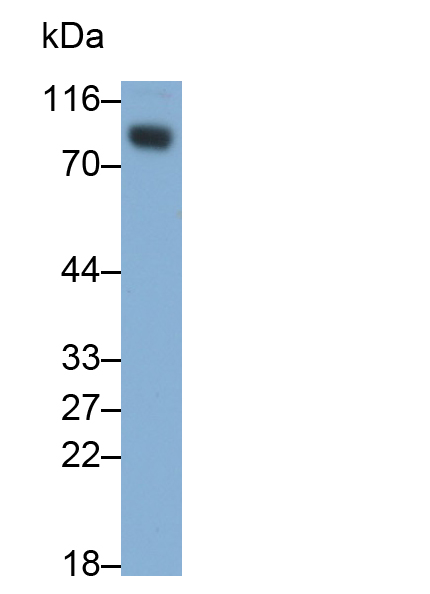 Monoclonal Antibody to Cluster Of Differentiation 19 (CD19)