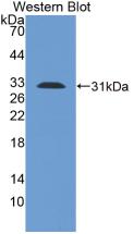 Monoclonal Antibody to Toll Like Receptor 1 (TLR1)