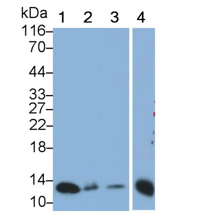 Monoclonal Antibody to S100 Calcium Binding Protein A2 (S100A2)