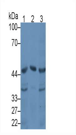 Monoclonal Antibody to Serpin A10 (SERPINA10)