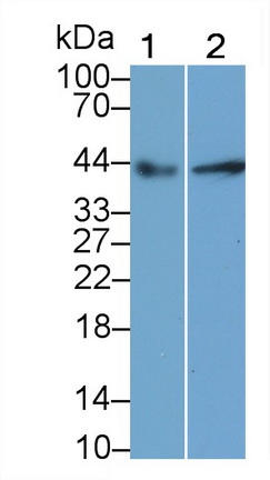 Monoclonal Antibody to Creatine Kinase B (CK-BB)