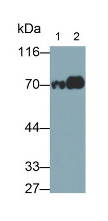 Monoclonal Antibody to Transferrin (TF)