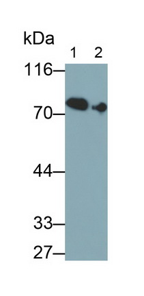 Monoclonal Antibody to Transferrin (TF)