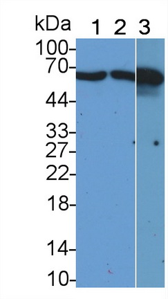 Monoclonal Antibody to SMAD family member 3 (SMAD3)
