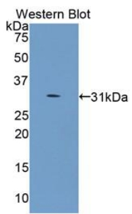 Monoclonal Antibody to Collagen Type IV Alpha 5 (COL4a5)
