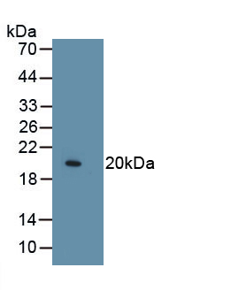 Monoclonal Antibody to Collagen Type VIII Alpha 1 (COL8a1)