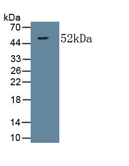 Monoclonal Antibody to Collagen Type V Alpha 2 (COL5a2)