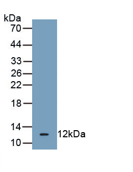 Monoclonal Antibody to Heat Shock 70kDa Protein 5 (HSPA5)