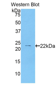 Monoclonal Antibody to Cathelicidin Antimicrobial Peptide (CAMP)
