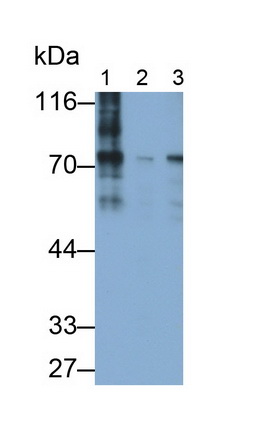 Monoclonal Antibody to Methyl CpG Binding Protein 2 (MECP2)