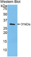 Monoclonal Antibody to Carbonic Anhydrase III, Muscle Specific (CA3)