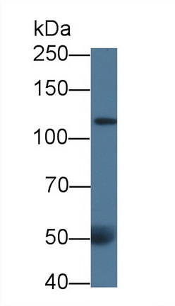 Monoclonal Antibody to Collagen Type III Alpha 1 (COL3a1)