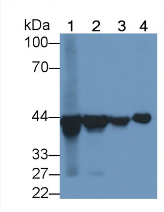 Monoclonal Antibody to Aspartate Aminotransferase 2 (AST2)