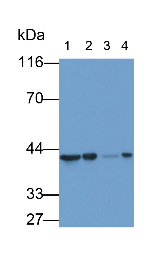 Monoclonal Antibody to Aspartate Aminotransferase 2 (AST2)