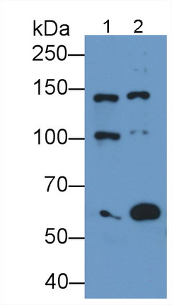 Monoclonal Antibody to Glutamate Receptor, Ionotropic, N-Methyl-D-Aspartate 2D (GRIN2D)