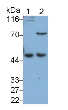 Monoclonal Antibody to Wilms Tumor Protein (WT1)
