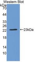 Monoclonal Antibody to Crystallin Beta B2 (CRYbB2)