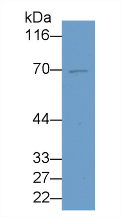 Monoclonal Antibody to Peptidyl Arginine Deiminase Type IV (PADI4)