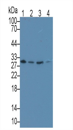 Monoclonal Antibody to Microtubule Associated Protein RP/EB Family, Member 1 (MAPRE1)