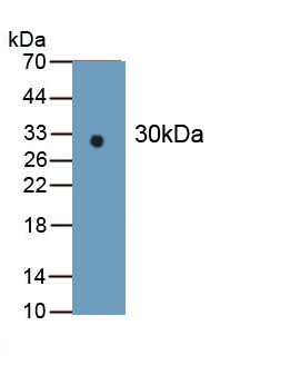 Monoclonal Antibody to Isocitrate Dehydrogenase 1, Soluble (IDH1)