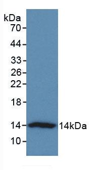 Monoclonal Antibody to V-Set Domain Containing T-Cell Activation Inhibitor 1 (VTCN1)