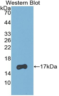 Monoclonal Antibody to Retinol Binding Protein 5, Cellular (RBP5)