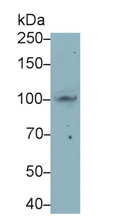 Monoclonal Antibody to Complement Component 4d (C4d)