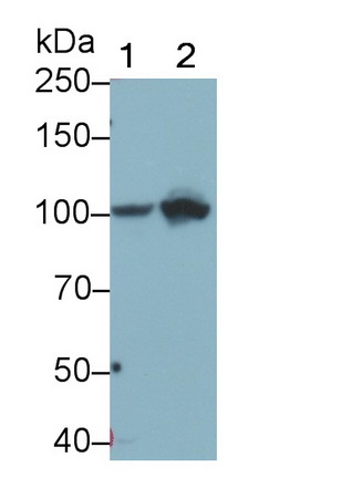 Monoclonal Antibody to Complement Component 4d (C4d)