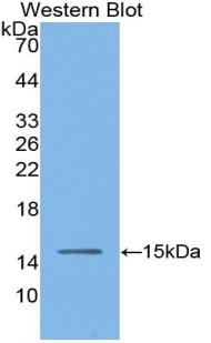 Polyclonal Antibody to Angiotensin I Converting Enzyme (ACE)