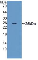 Polyclonal Antibody to Chemokine C-Motif Receptor 1 (XCR1)