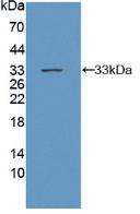 Polyclonal Antibody to Glycoprotein 130 (gp130)