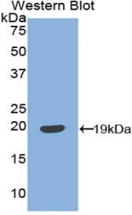 Polyclonal Antibody to Insulin Like Growth Factor Binding Protein 3 (IGFBP3)