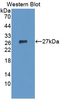 Polyclonal Antibody to Interleukin 12A (IL12A)