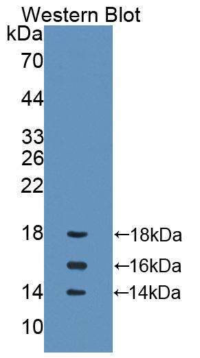 Polyclonal Antibody to Interleukin 15 (IL15)