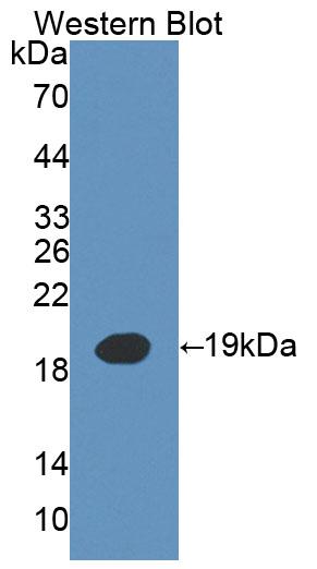 Polyclonal Antibody to Interleukin 3 (IL3)
