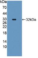 Polyclonal Antibody to Protein SCAF11 (SCAF11)