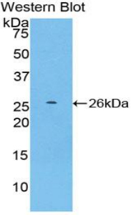 Polyclonal Antibody to Protein SCAF11 (SCAF11)