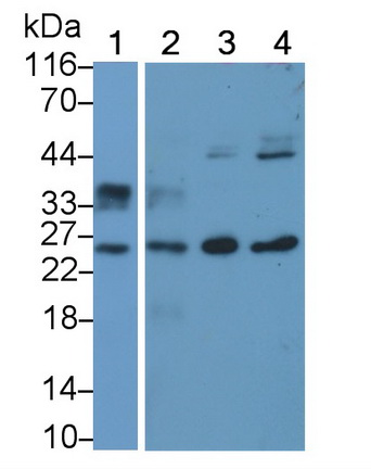Polyclonal Antibody to Ribonuclease T2 (RNASET2)